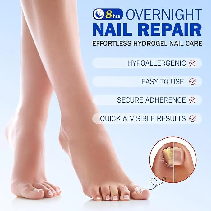 Fungal Nail Treatment Patches – Fast-Acting Antifungal Repair for Healthy Nails