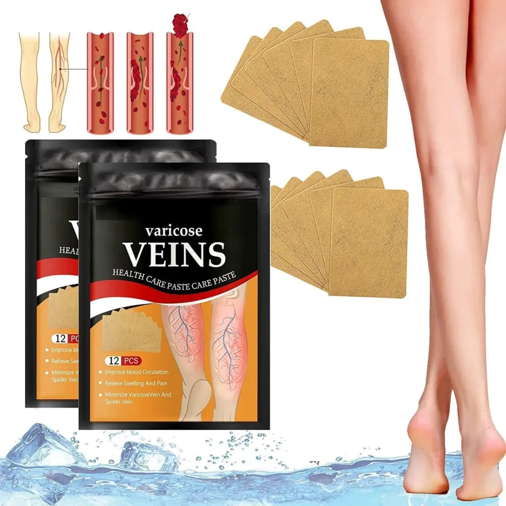 Varicose Veins Health Care Paste | Pain Relief & Blood Circulation Support