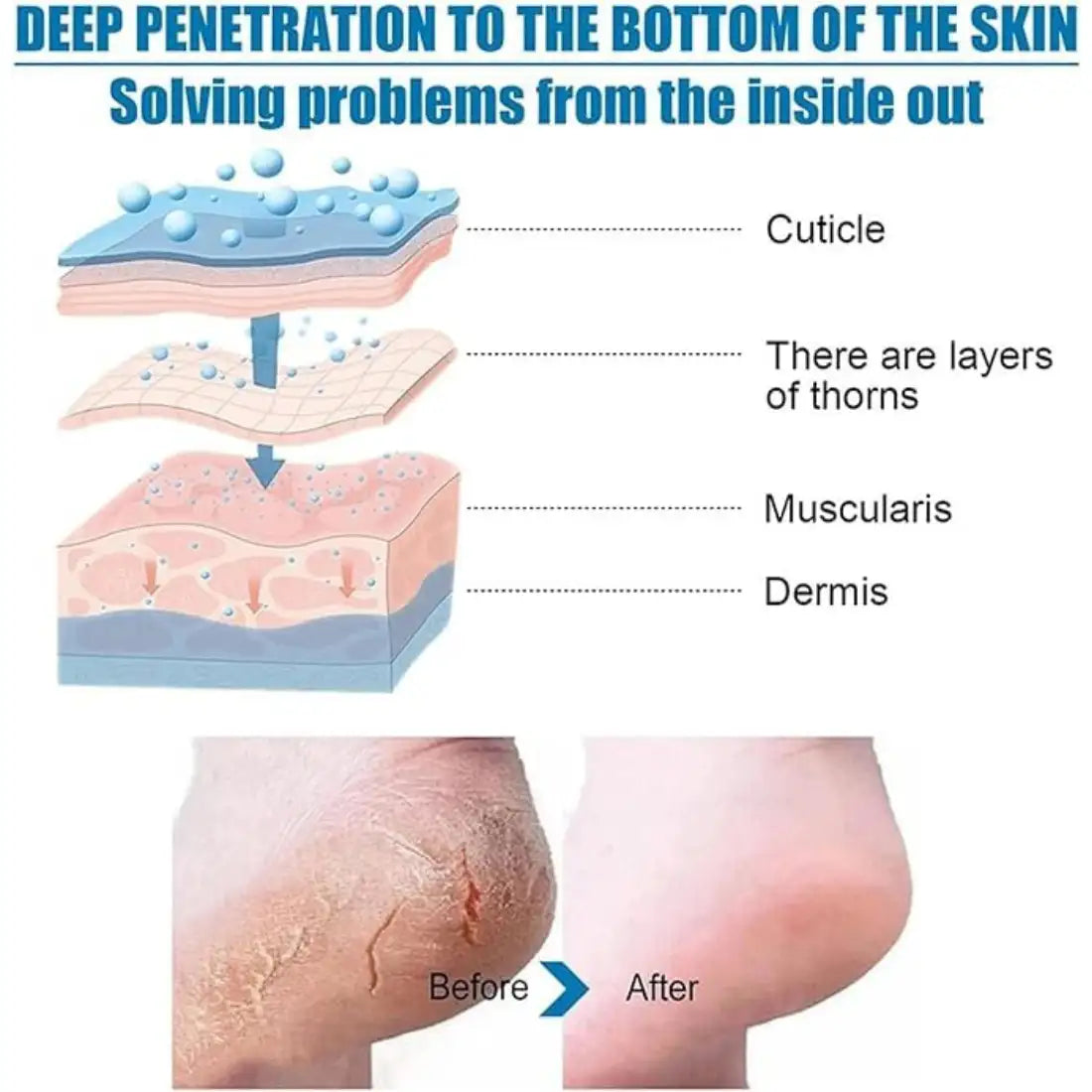 Goat Milk Exfoliating Foot Mask with Nicotinamide | Deep Moisturising & Dead Skin Removal Foot Mask